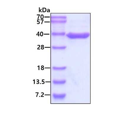 SDS-Page: Recombinant Human ASPA Protein [NBP2-52289] - 3ug by SDS-PAGE under reducing condition and visualized by coomassie blue stain.